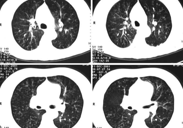 【总结文章“中至二人麻将可以开挂不”揭秘透视辅助万能挂